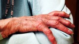 Is Dementia Screening Worth It?