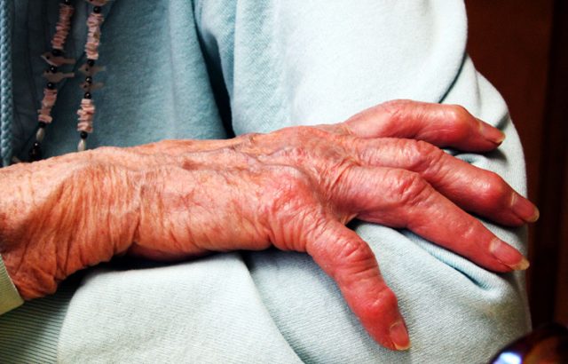 Is Dementia Screening Worth It?