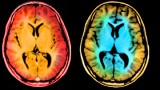 The Brain Scan Appeal