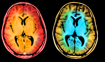 The Brain Scan Appeal