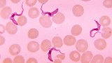 Reinvigorating the battle against an old disease