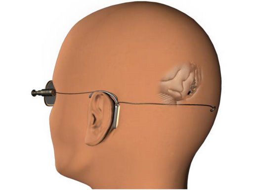 Within reaching distance of mind-controlled movement