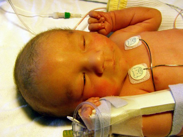 The case of the malodorous infant