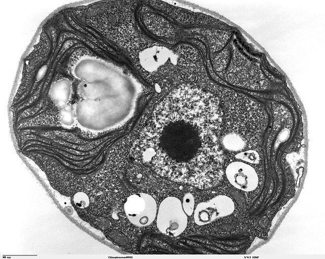 Evolutionary conundrum of the day: Single-celled organisms kill themselves