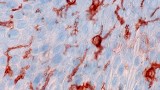 Immunologists win big in this year’s Nobel Prize for Physiology or Medicine