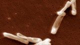 Fecal transplants: the scoop on therapeutic poop