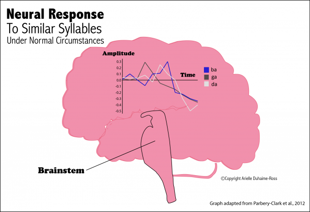 Neural Response Graphic