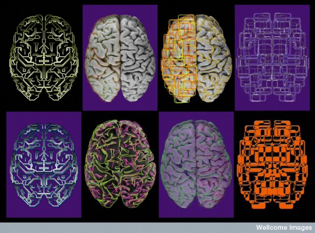 Getting inside your head