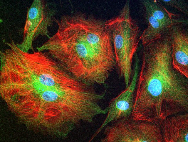 Nobel prize in physiology recognizes the cargo delivery system in our cells