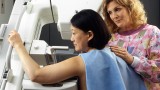 Another piece in the breast cancer puzzle