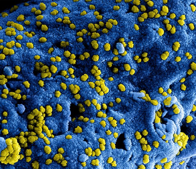 The story of MERS gets murkier