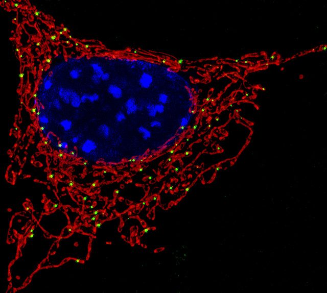 A three-parent baby? Not really.