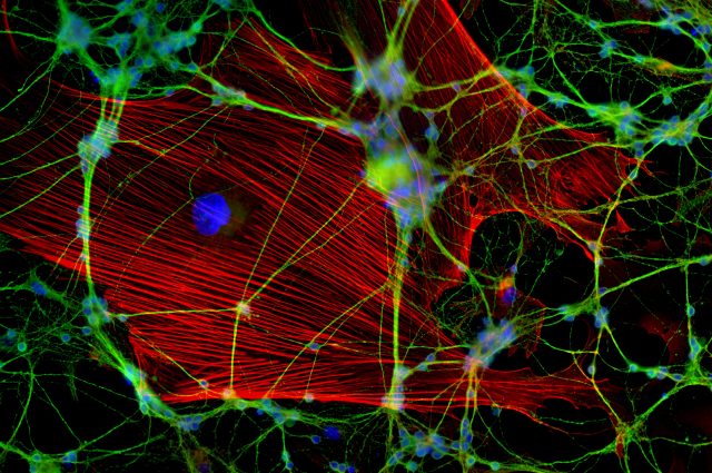 A twinkle of light in a microscope’s eye