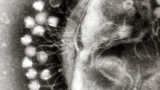 Could a forgotten therapy become the new panacea to untreatable superbugs?