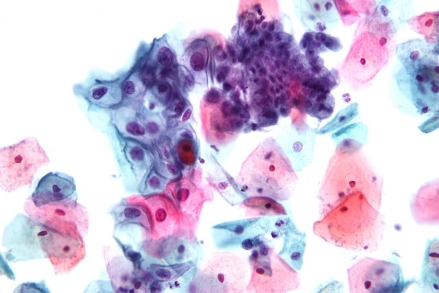 A guide to cervical cancer screenings at every age