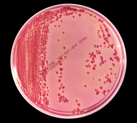 <i>Klebsiella pneumoniae</i> bacteria, responsible for deadly hospital infections. [CREDIT: CDC]