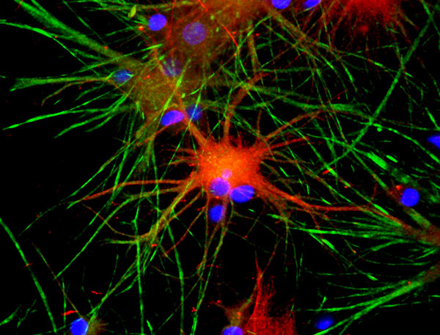 Neuroepithelial stem cells. [CREDIT: ORION BIOSOLUTIONS]