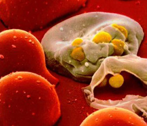 A microscopic view of a cell infected with HIV [CREDIT: csend.hu]