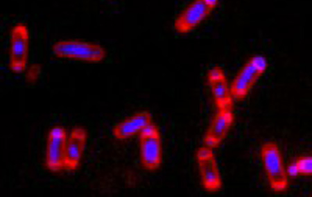 Bacillus subtilis going into lockdown mode. This spore-forming bacteria is a close cousin of anthrax.                            
                   
[Credit: Patrick Eichenberger]