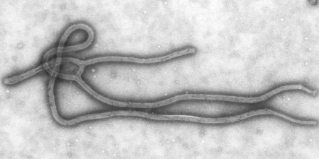 A transmission electron micrograph of the Ebola Virus. [Credit: Cynthia Goldsmith/CDC]