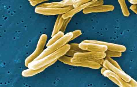 An extreme closeup of the tuberculosis bacteria. <br>Doctors are now seeing some success in treating the drug resistant form of this disease. <br>[Credit: CDC/ Dr. Ray Butler; Janice Carr]