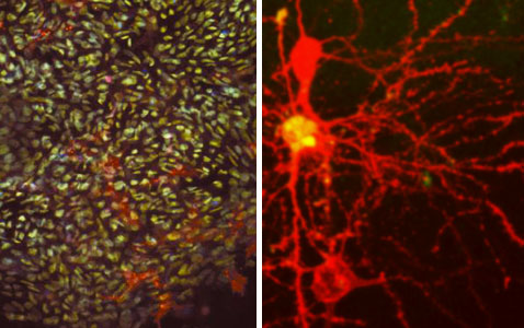 Scientists turn skin cells into stem cells (left), and then into neurons (right), and now wait for them to die. <br>[Credit: Left-NIH, Right-Arnaud333]