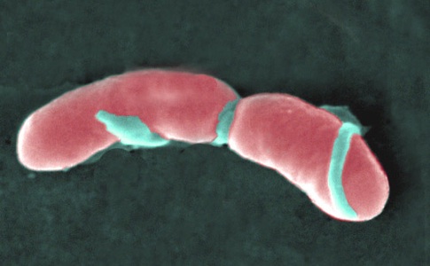 <em>Listeria monocytogenes</em>, shown here, is a bacterial species commonly found in the human gut.  New<br>research shows that mice exposed to intestinal microbes were less likely to develop Type 1 diabetes.<br>  [Credit: AJ Cann, flickr.com].