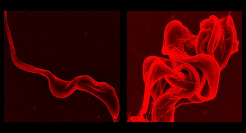 A normal <em> T. brucei </em> parasite (left) mutates after being exposed to rapamycin (right).  Scientists might be able <br> to use this mechanism to treat African sleeping sickness.  [Credit: Antonio Barquilla]