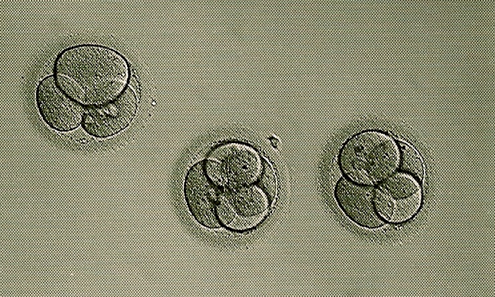 Eggs fertilized using in vitro fertilization.  A new study evaluates the risk of procedures like IVF [Credit: <br> Lorena & David, flickr.com].
