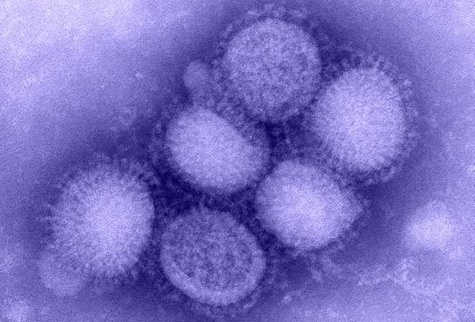 The virus behind the swine flu: H1N1 [Credit: AJ Cann, flickr.com].