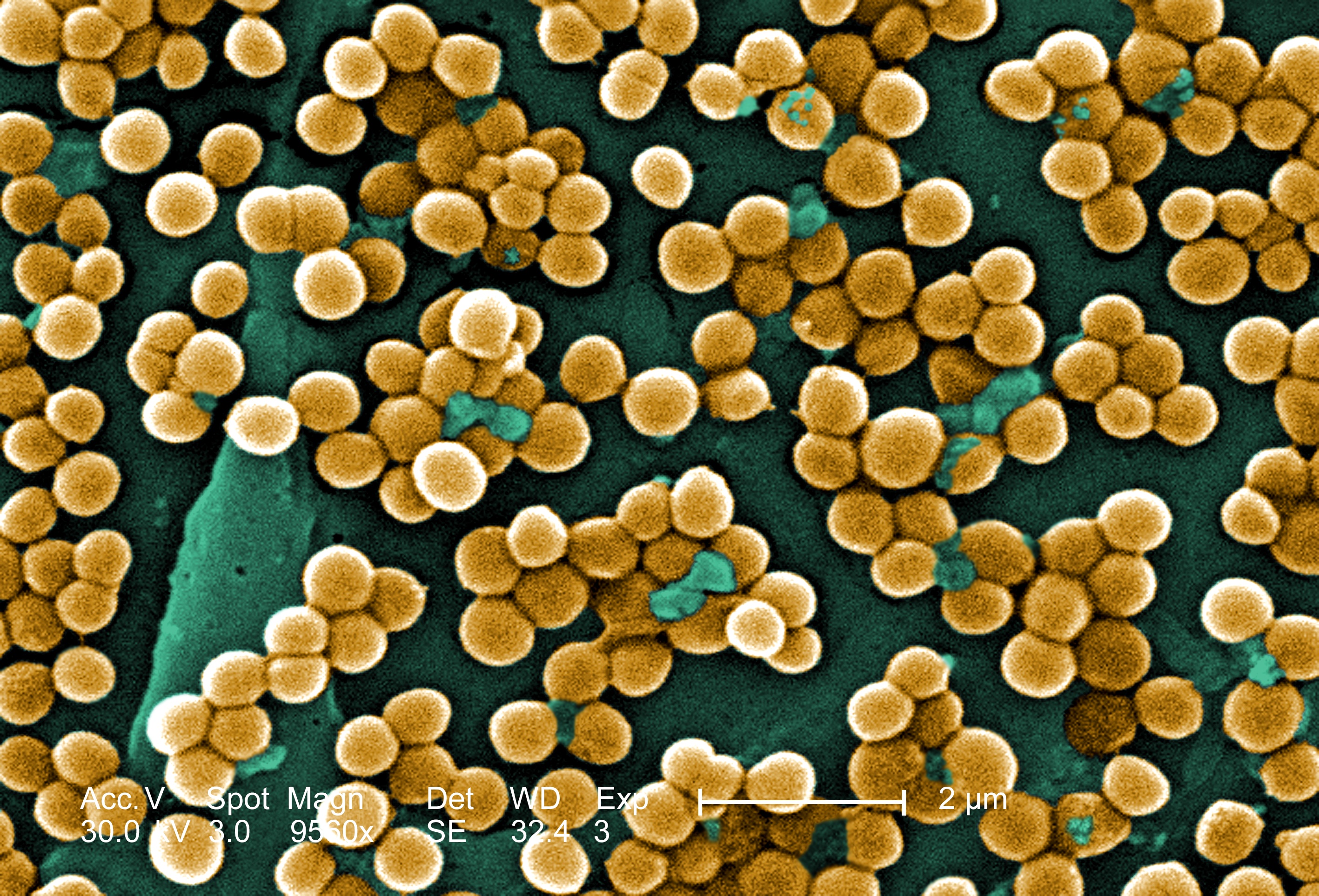 Mineral Monday: Olivine - Scienceline