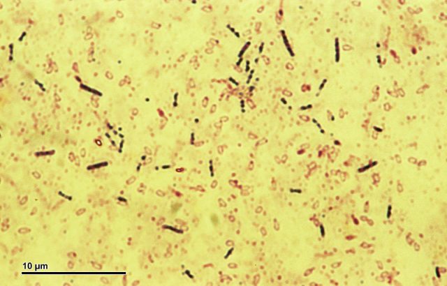 Eubacteria_(259_11)_Bacillus_subtilis_bacteria » Scienceline