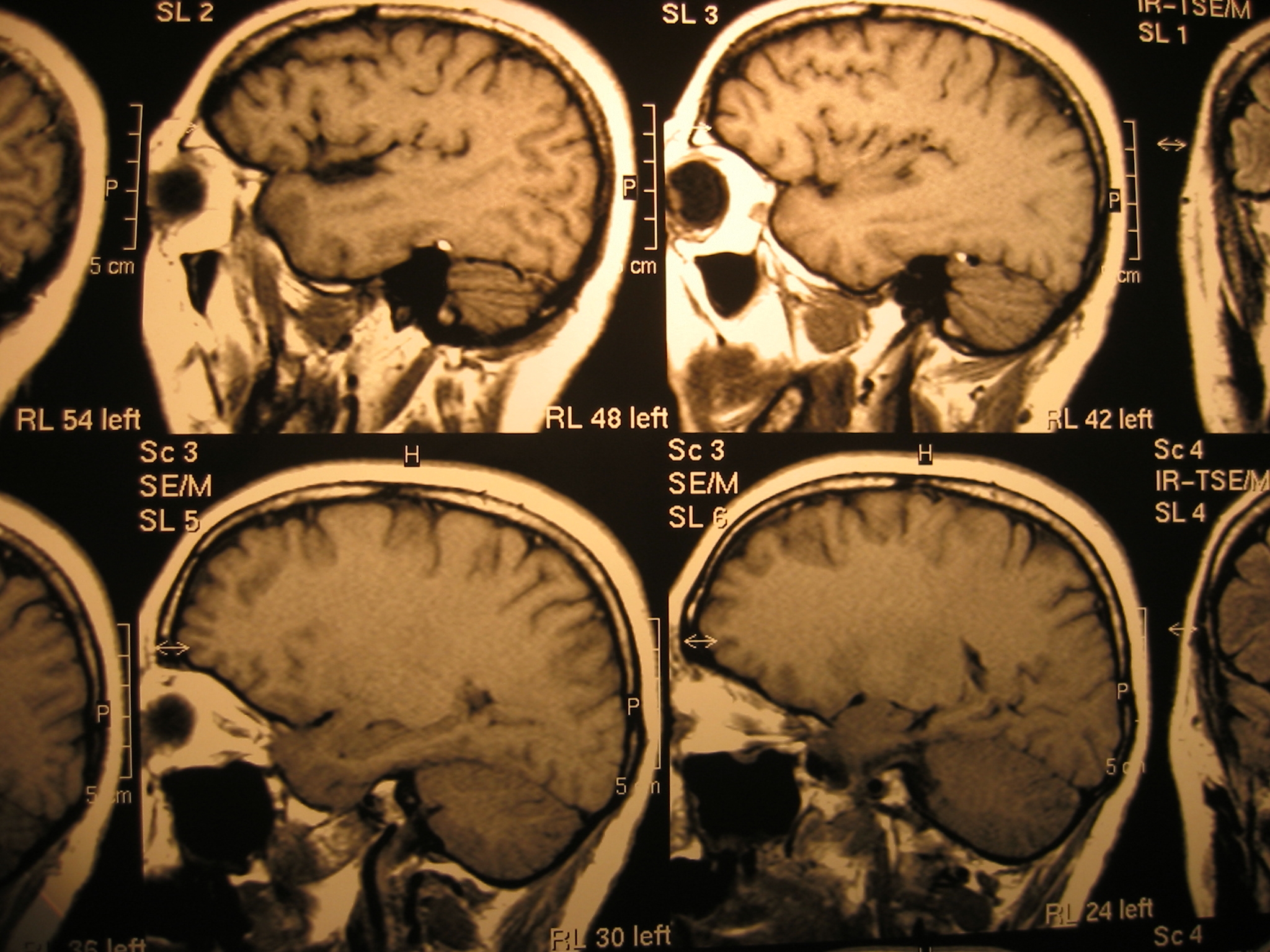 Multiple x-ray scans of a brain and skull