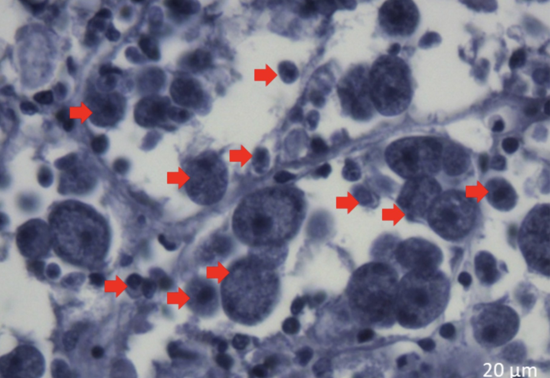 Microscopic image of oval shaped parasite cells marked with red arrows